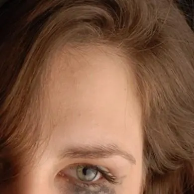 Malos tratos Problemas psicológicos derivados de los malos tratos, físicos o psicológicos